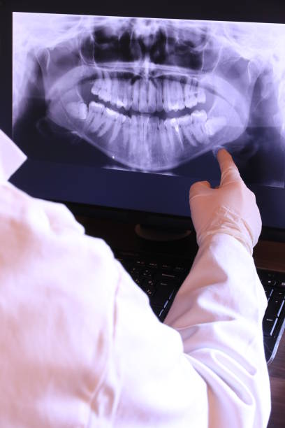 Best Emergency Tooth Extraction in Westminster, TX