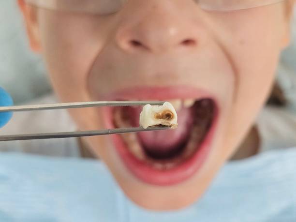 Best 24-Hour Emergency Dentist in Westminster, TX